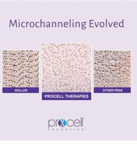 procell-therapies-md-microchanneling-device-with-charger-and-2-cordless-batteries-big-1