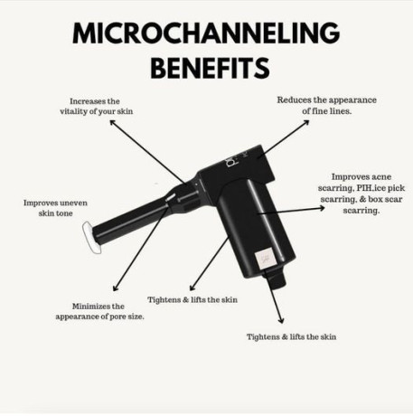 procell-therapies-md-microchanneling-device-with-charger-and-2-cordless-batteries-big-2