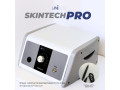 skintech-pro-skin-lesion-rf-machine-small-0