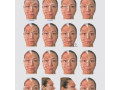 botulinum-toxin-chart-poster-small-0